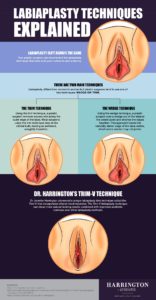 Harrington Labiaplasty Infographic Apr v