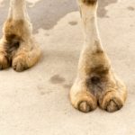 camel toe liposuction