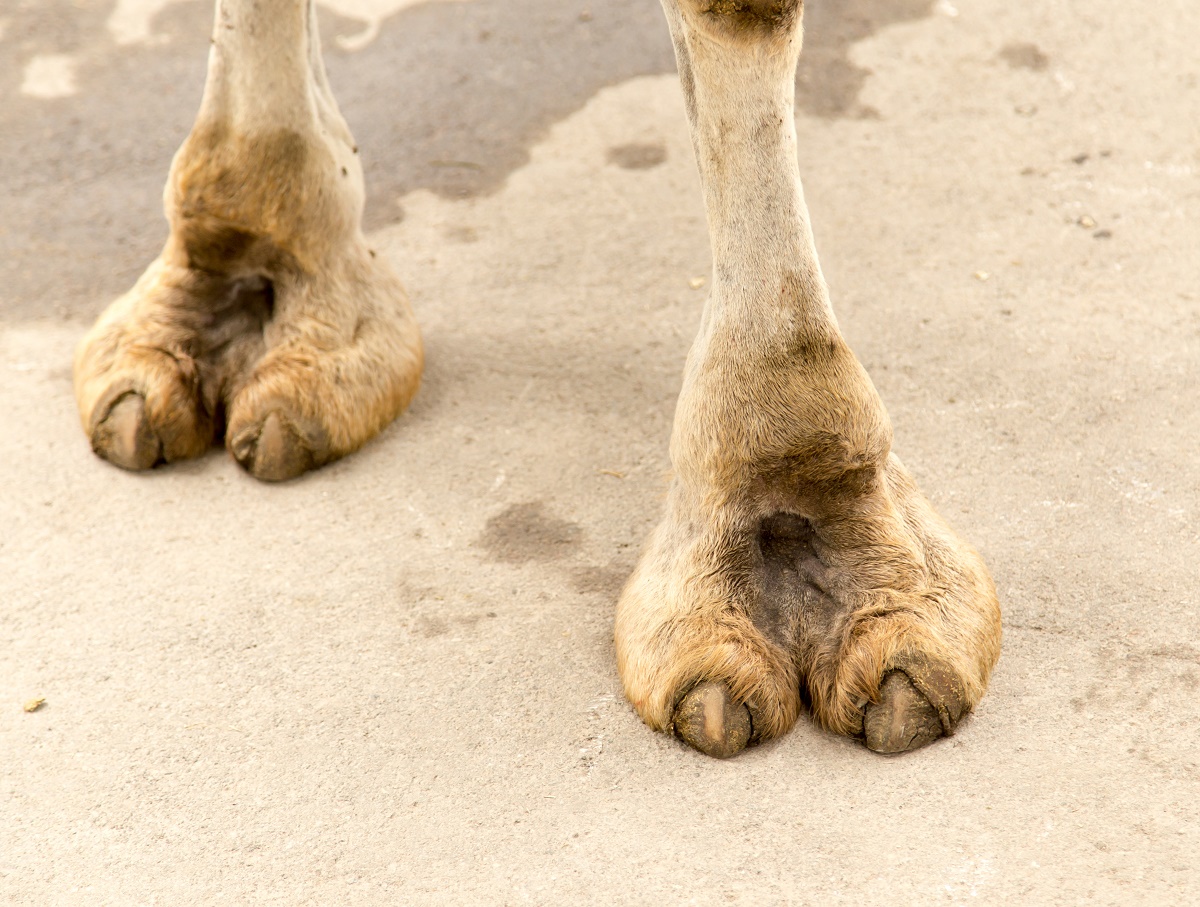 Don't Love Your Camel Toe? There's Liposuction for That